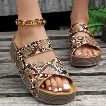 Victoria™ - Sandalias Ortopédicas con Estilo